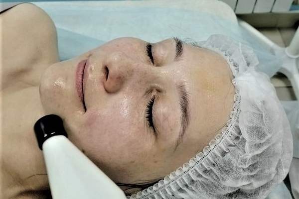 Биомеханическая стимуляция мышц лица